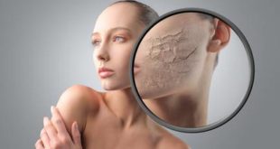 Que faire pour une peau déshydratée ?