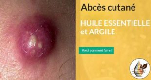 abcès cutanée huile essentielle et argile